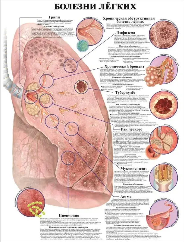 Болезни организма и травматология. Плакаты для колледжа и медучреждений
