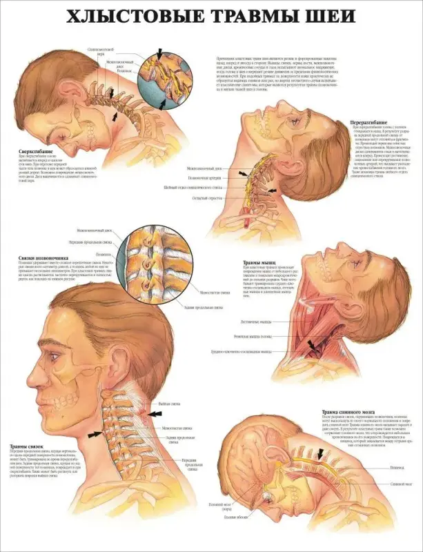 Болезни организма и травматология. Плакаты для колледжа и медучреждений