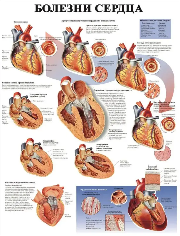Болезни организма и травматология. Плакаты для колледжа и медучреждений