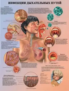 Болезни организма и травматология. Плакаты для колледжа и медучреждений