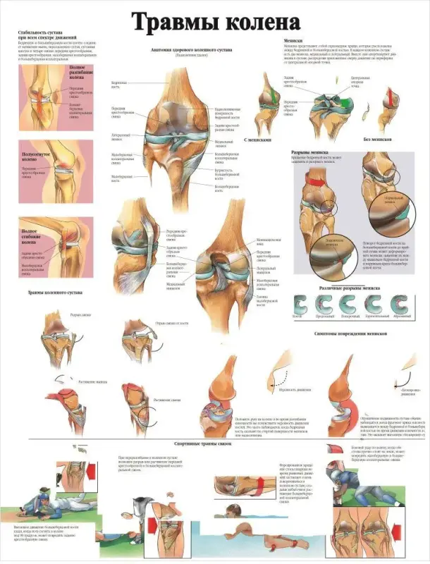 Болезни организма и травматология. Плакаты для колледжа и медучреждений