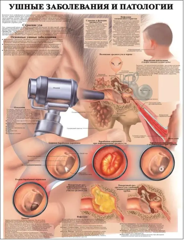 Болезни организма и травматология. Плакаты для колледжа и медучреждений