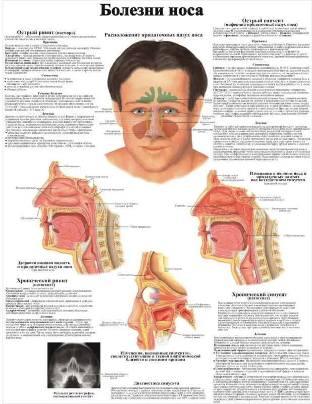 Болезни организма и травматология. Плакаты для колледжа и медучреждений