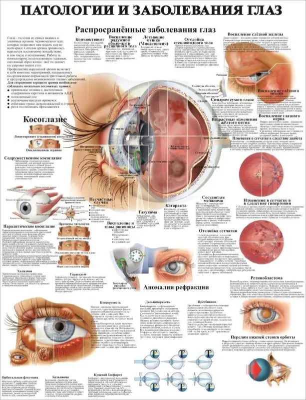 Болезни организма и травматология. Плакаты для колледжа и медучреждений