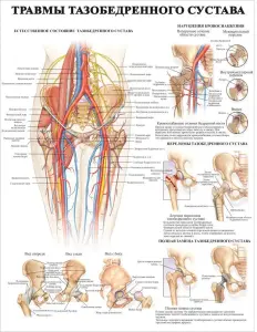 Болезни организма и травматология. Плакаты для колледжа и медучреждений