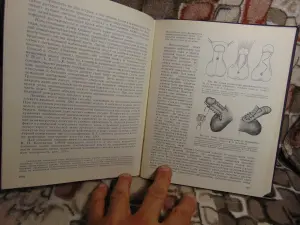 Книга Аномалии мочеполовой системы Н.А.Лопаткин, А.В.Люлько, Киев, 1987 год