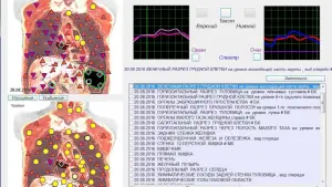 Приборы компьютерной диагностики организма Mageric Biotest Pro.