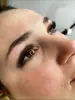 Ресницы