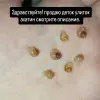 Улитки