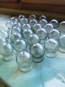 СССР. Банки медицинские 30 шт. Цена за все