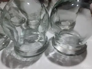 Банки медицинские СССР