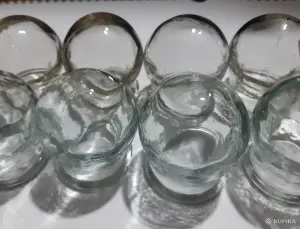 Банки медицинские СССР