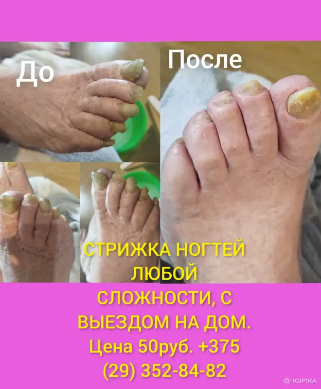 СТРИЖКА НОГТЕЙ