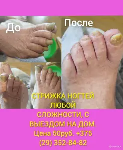СТРИЖКА НОГТЕЙ